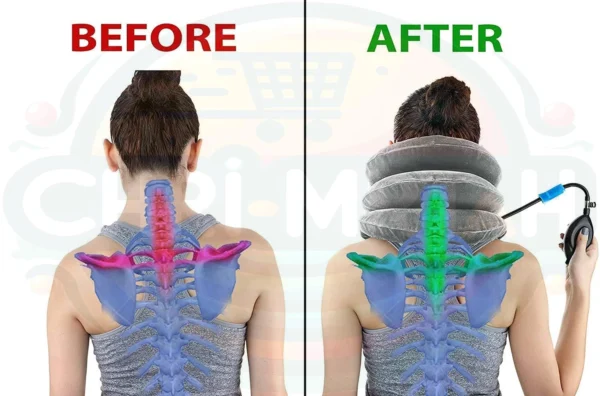 Air Cervical Traction Neck