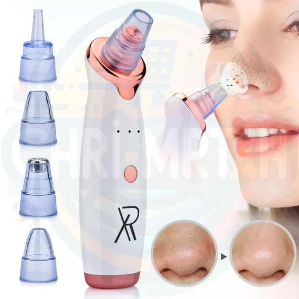 Blackhead Remover