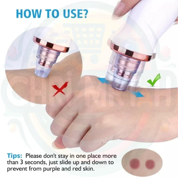 Blackhead Remover