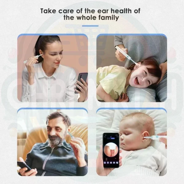 Otoscope Ear Cleaner