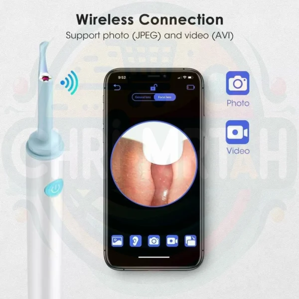 Otoscope Ear Cleaner