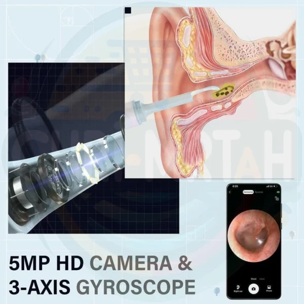 Otoscope Ear Cleaner