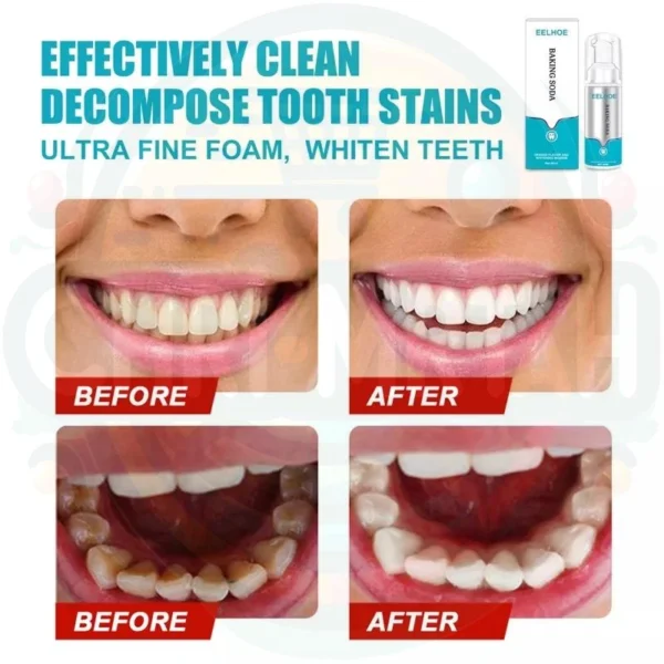 Toothpaste For Whitening